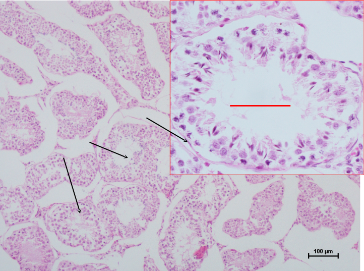 Testis 1