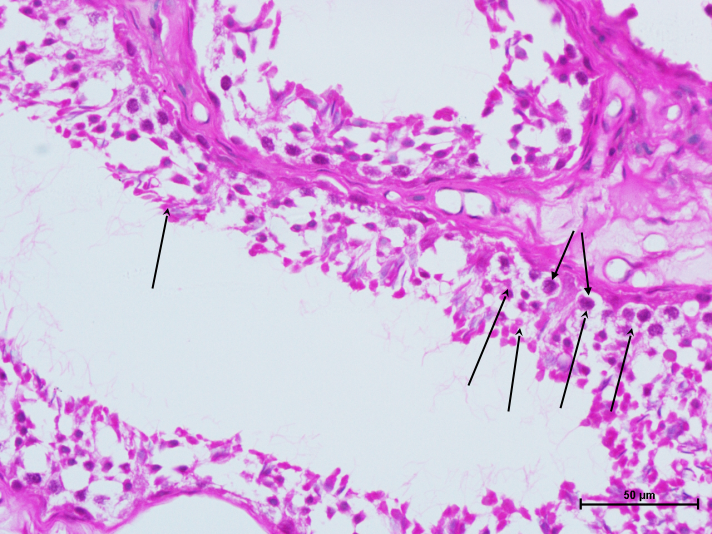 Testis 3