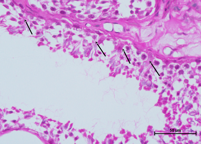 Testis 5