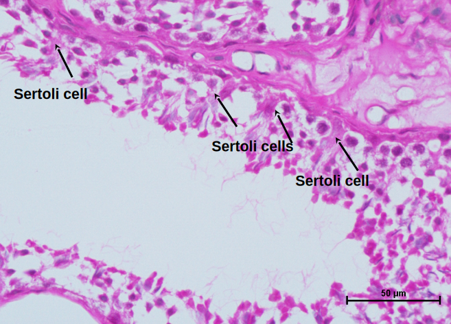 Testis 6