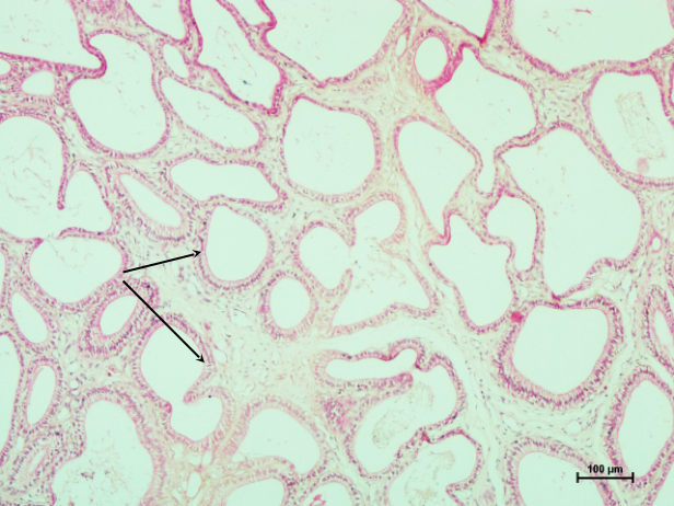 Vesicular Gland 1