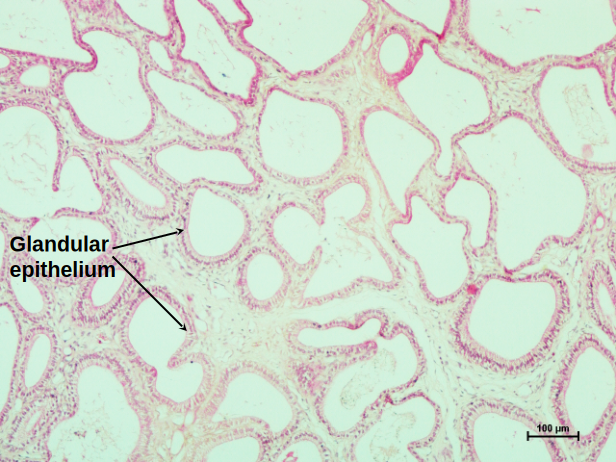 Vesicular Gland 2