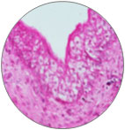 Transitional Epithelium
