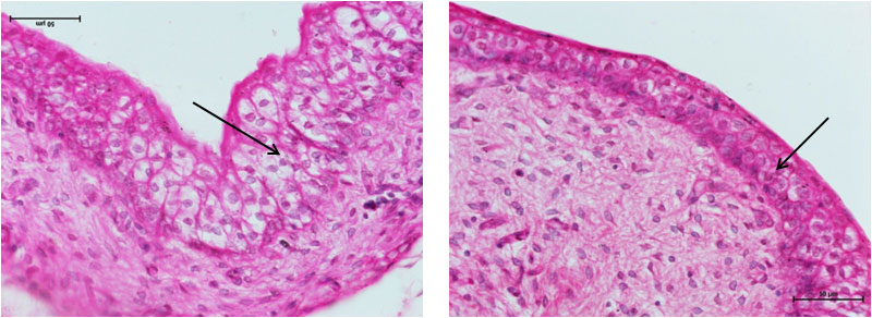 Transitional Epithelium
