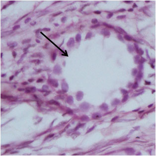 Ductus Deferens 1