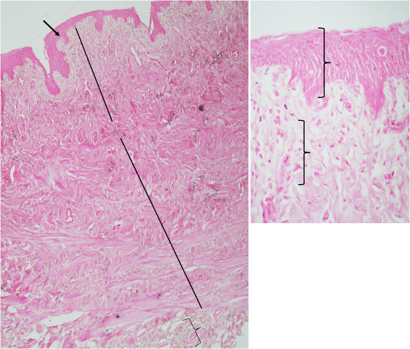 Ductus Deferens 1