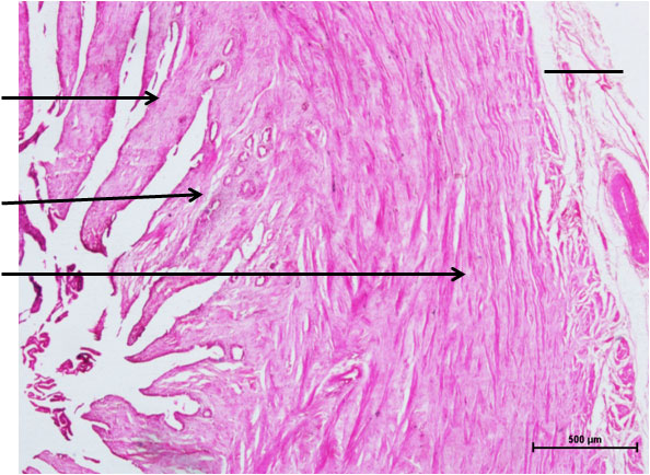 Ductus Deferens 1