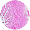 Cervix