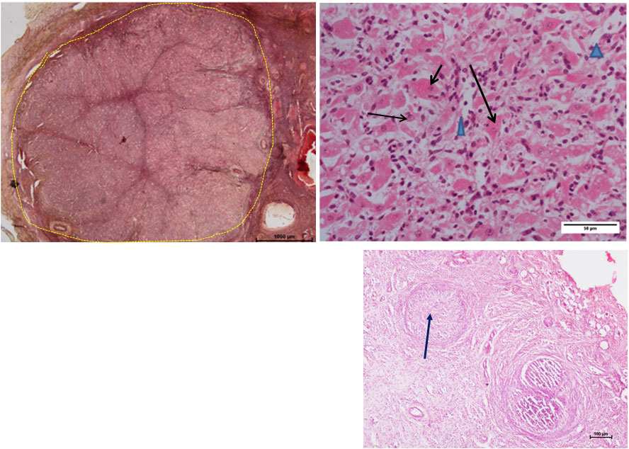 Ductus Deferens 1
