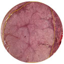 Corpus luteum