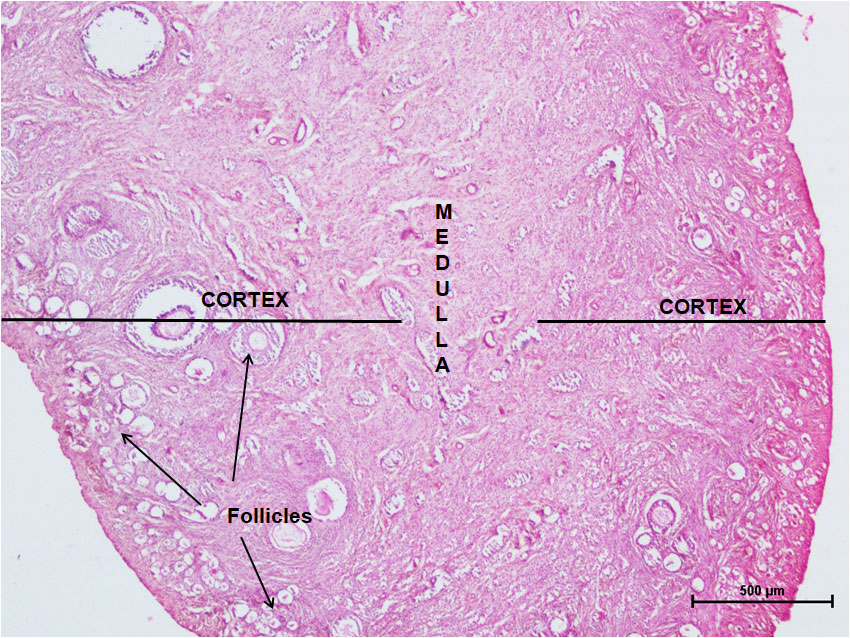 Ductus Deferens 2
