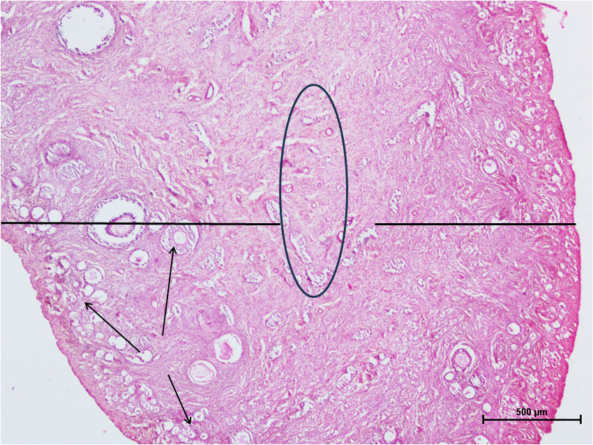 Ductus Deferens 1