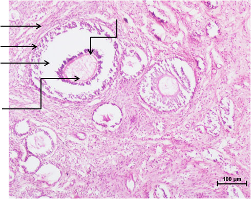 Ductus Deferens 1