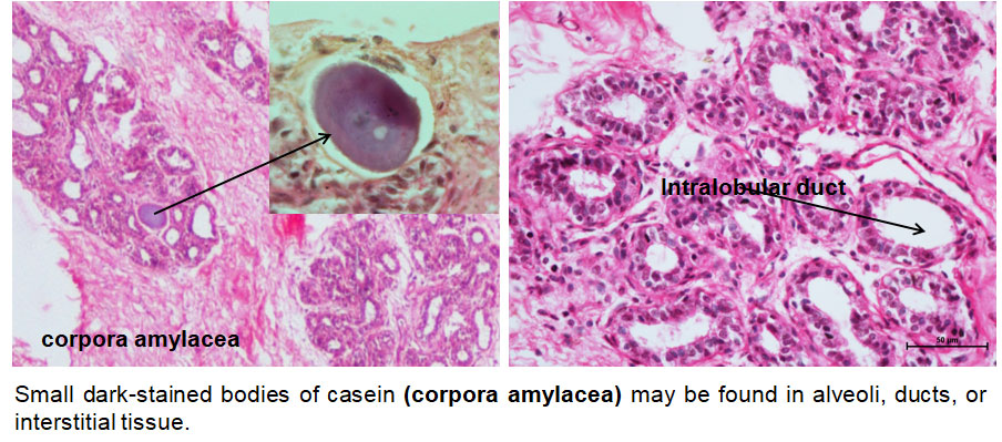 Ductus Deferens 2