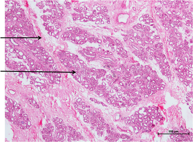 Ductus Deferens 1