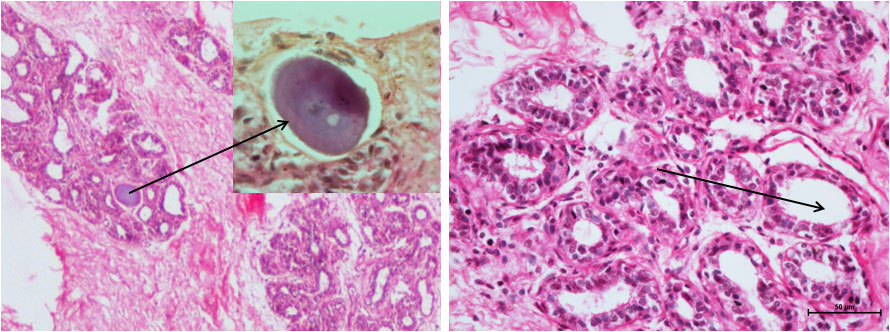 Ductus Deferens 1