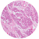Mammary gland