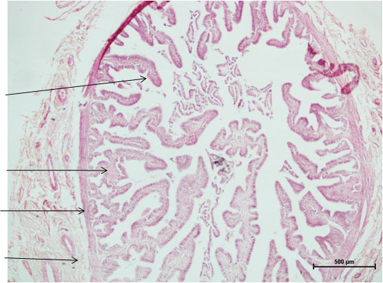 Ductus Deferens 1