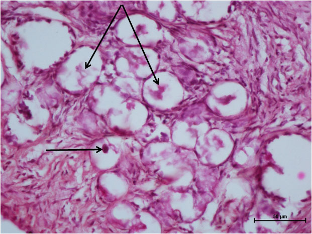 Ductus Deferens 1