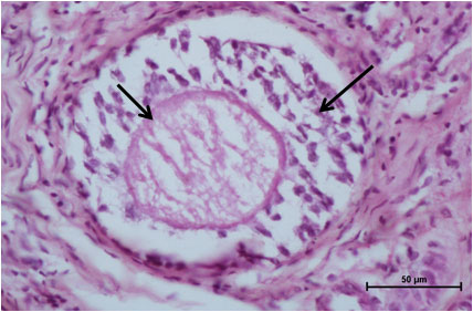 Ductus Deferens 1