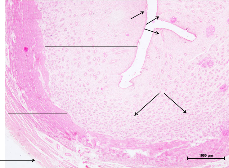 Ductus Deferens 1