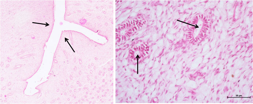 Ductus Deferens 1
