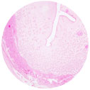 Uterus