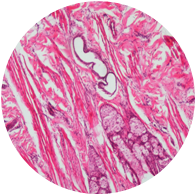 Adrenal Gland