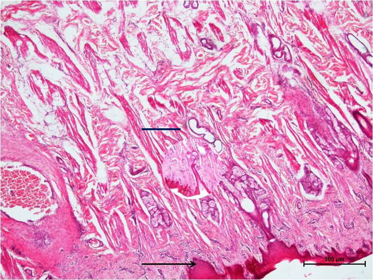 Oesophagus 1