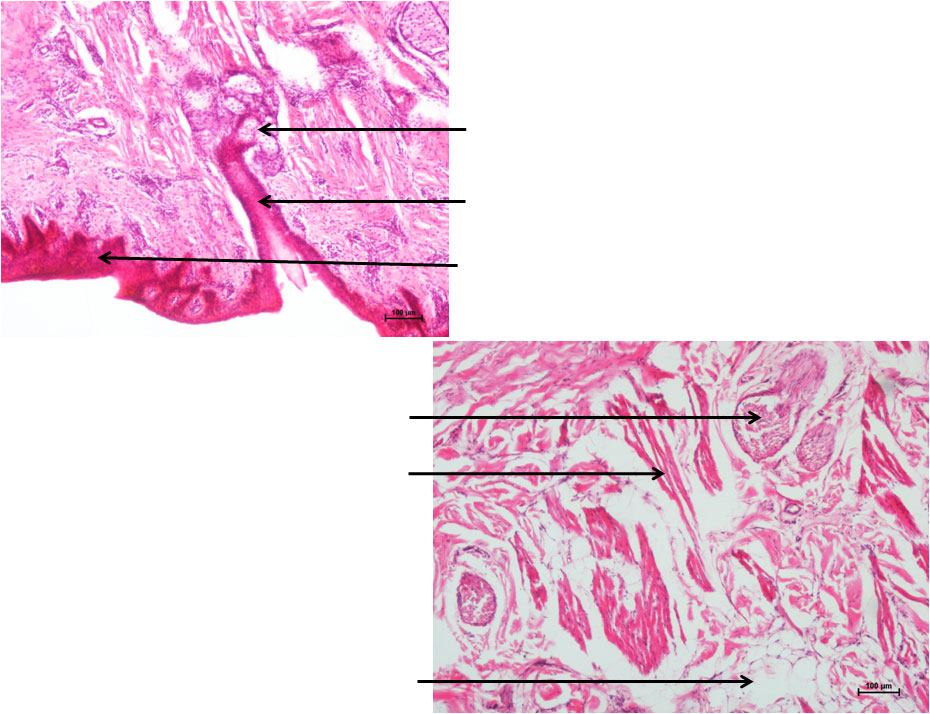 Oesophagus 3